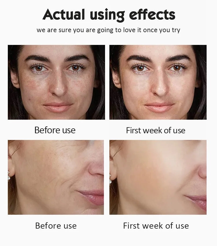 Before and after effects of a skincare product on a woman's face.