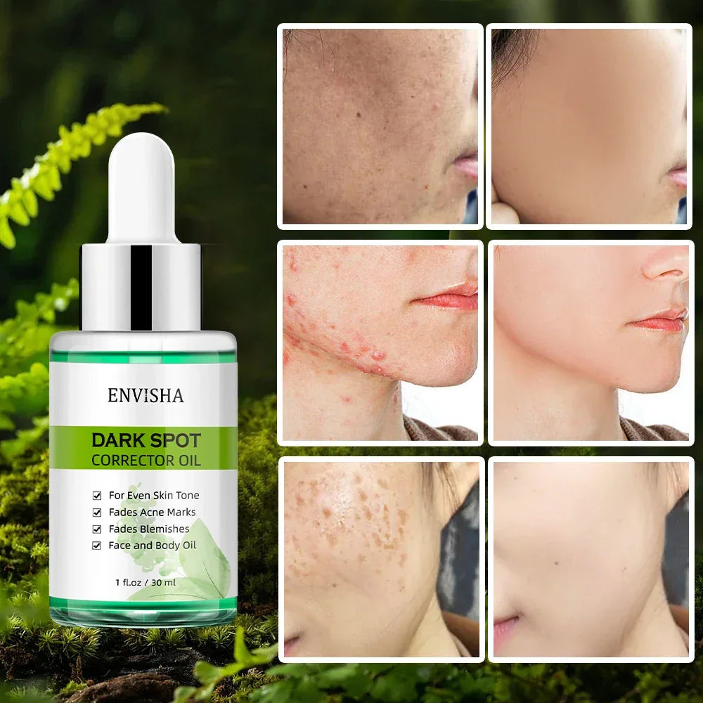 ENVISHA Dark Spot Corrector & Brightening Face Oil – 30ml Face Oil ENVISHA