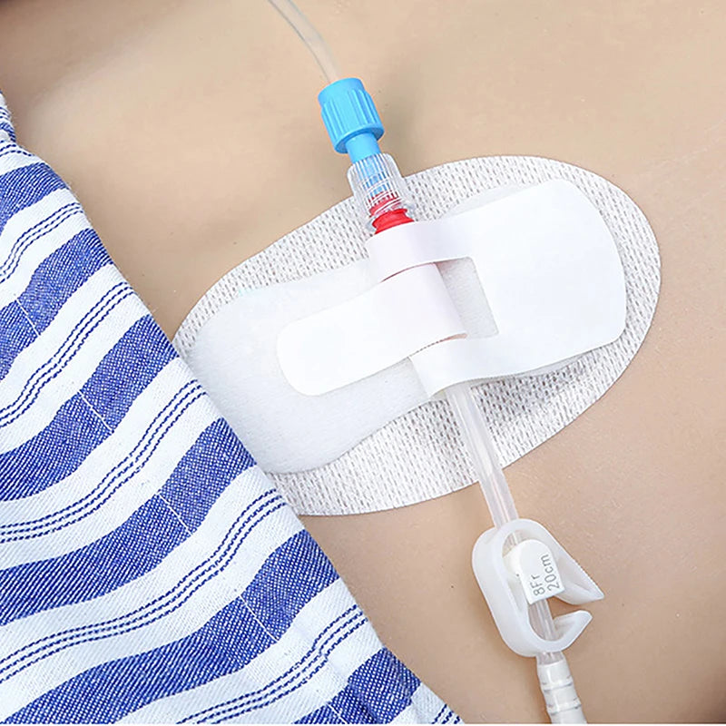 Catheter Holder Tube Sticker Bag Strap Urinary Leg Legband Adhesive Fixing Band Device Anchor G Stabilization Nephrostomy Peaceful Pleasures Health and Wellness