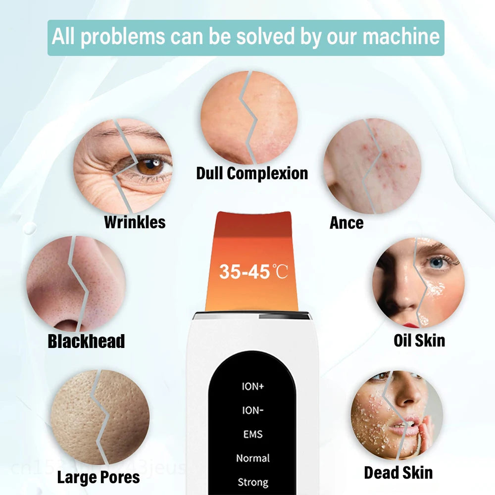 Ultrasonic Skin Scrubber Peeling Blackhead Remover Deep Face Cleaning Ultrasonic Ion Ance Pore Cleaner Facial Shovel Cleanser Peaceful Pleasures Health and Wellness