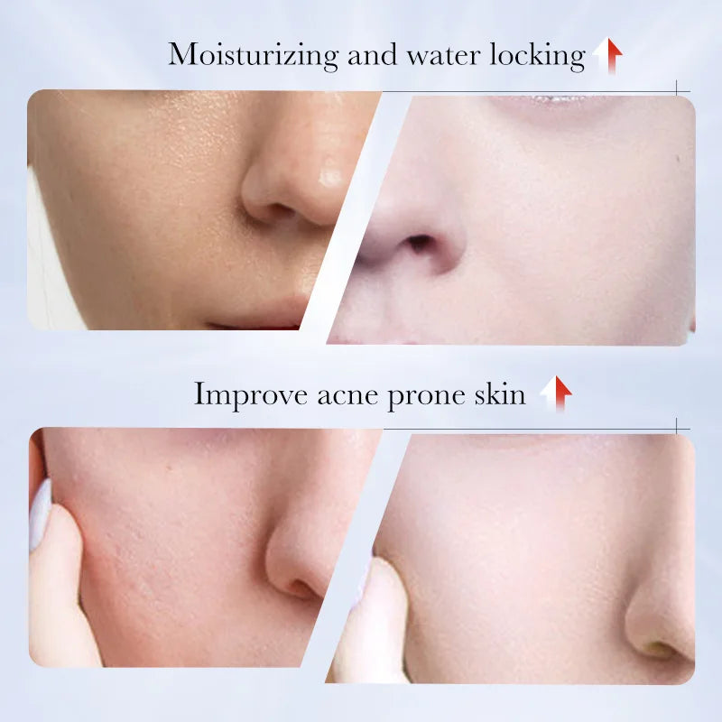 1/2/4pcs SADOER Kojic Acid Face Cream Moisturizing Freckle Removing Creams Brightening Hydrating Facial Cream Skin Care Products Peaceful Pleasures Health and Wellness