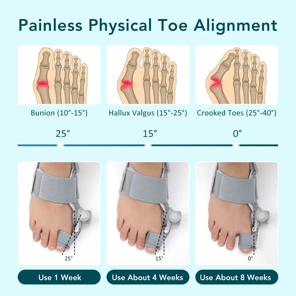 Bunion Corrector Big Toe Hallux Valgus Foot Brace Angle Adjuster Bone Thumb Straightener Orthopedic Strap Pedicure Care Tool Peaceful Pleasures Health and Wellness