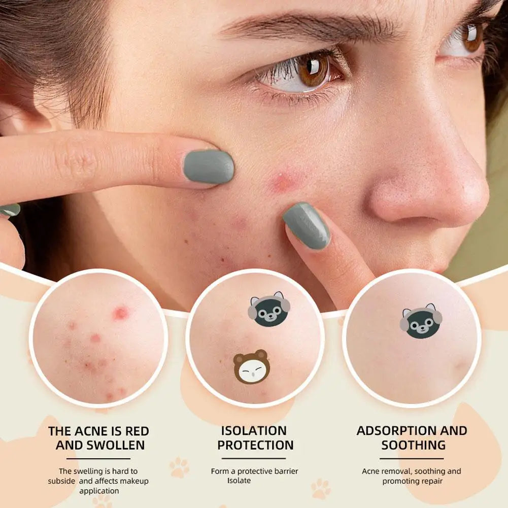 Cute Cat Cartoon Acne Patches – Hydrocolloid Blemish Dots 220pc