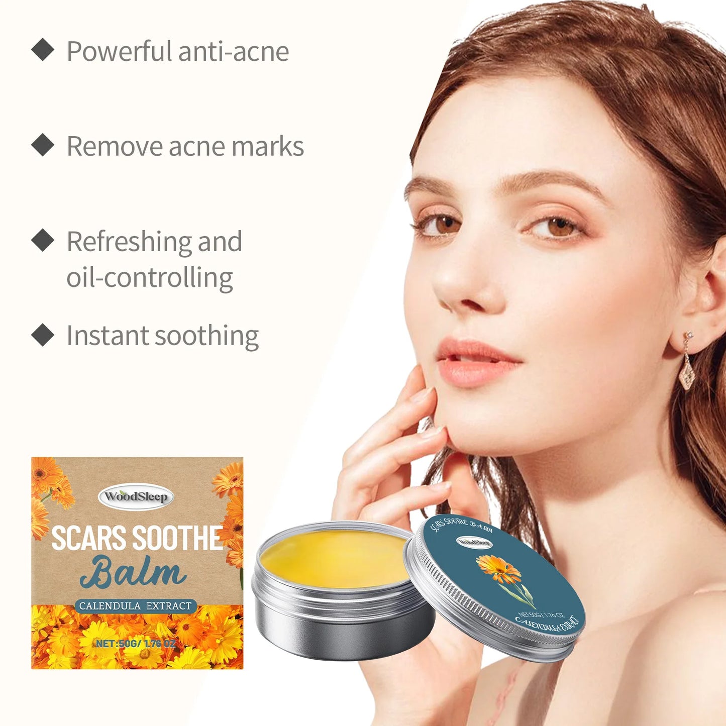 Calendula Acne Cream – Scar Fading, Oil Control & Pore Shrinking