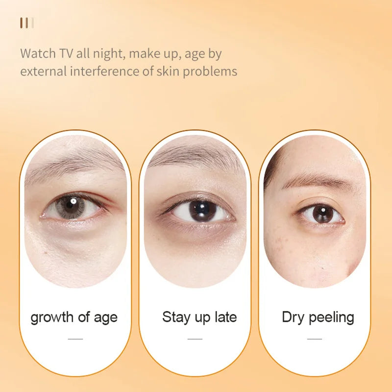 SADOER Vitamin C Eye Cream – Dark Circles & Puffiness