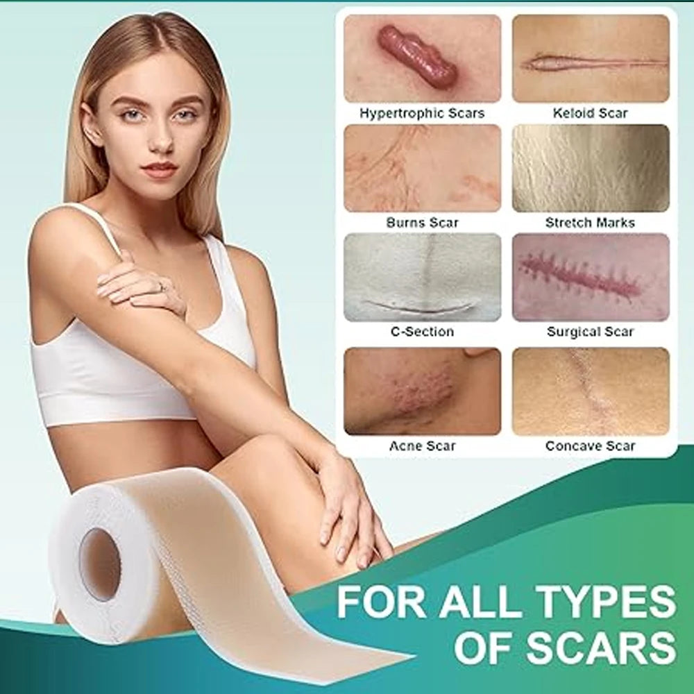 Silicone Scar Tape Roll – Keloid, Surgical & Acne Scar Sheets Silicone Scar Tape Peaceful Pleasures Health and Wellness