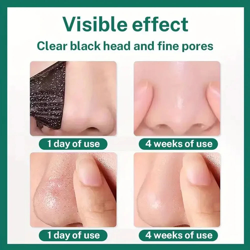 Unisex Deep Cleansing Nose Strips for Acne & Blackhead Removal Shrink Pore Nose Black Head Stickers Skin Care Patch Peaceful Pleasures Health and Wellness