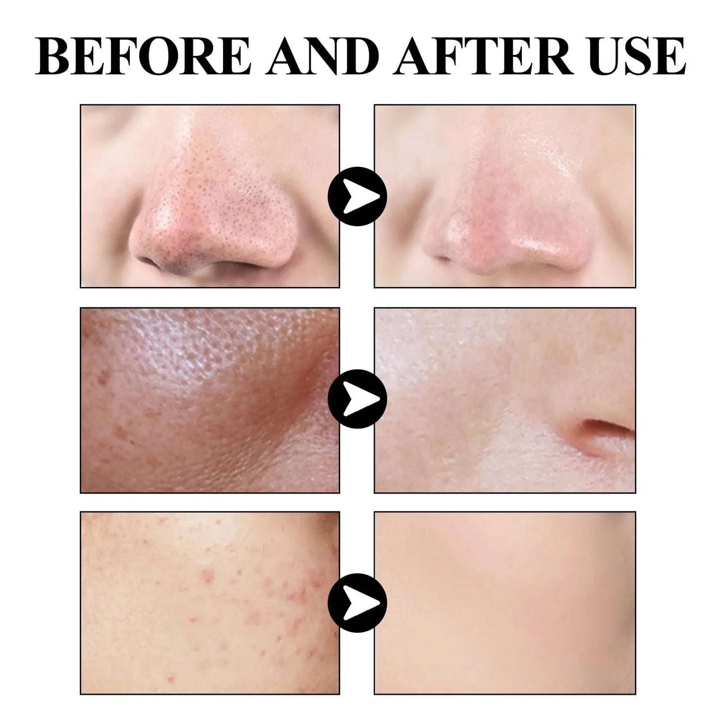 Blackhead Cleansing Mud Mask 40g – Pore-Purifying & Brightening