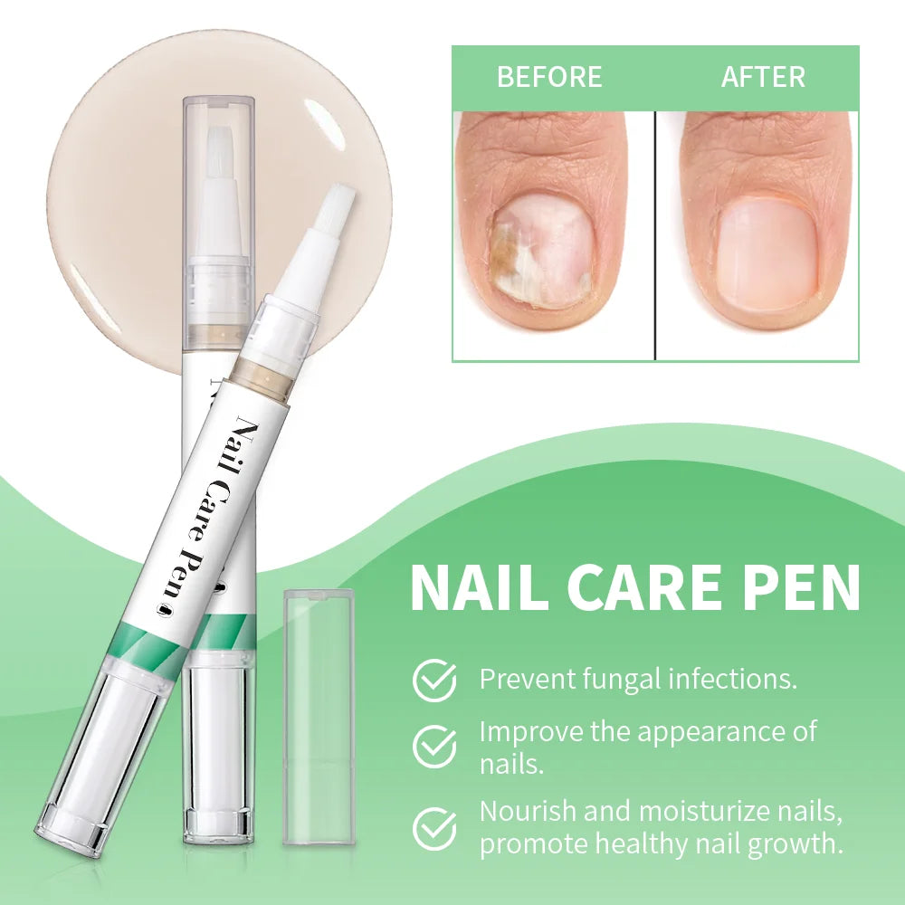 Nail Care Pen Nourish and Moisturize Nails Prevent Fungal Infections Improve Appearance Flat Brush Head Design Daily Nail Care Peaceful Pleasures Health and Wellness
