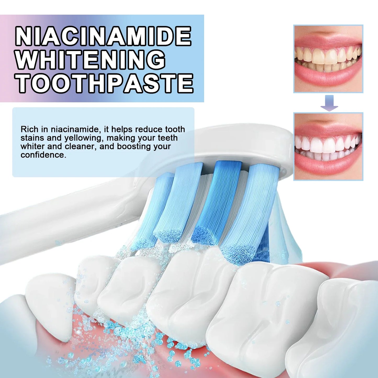 Niacinamide Whitening Toothpaste – Brightens & Freshens 100g