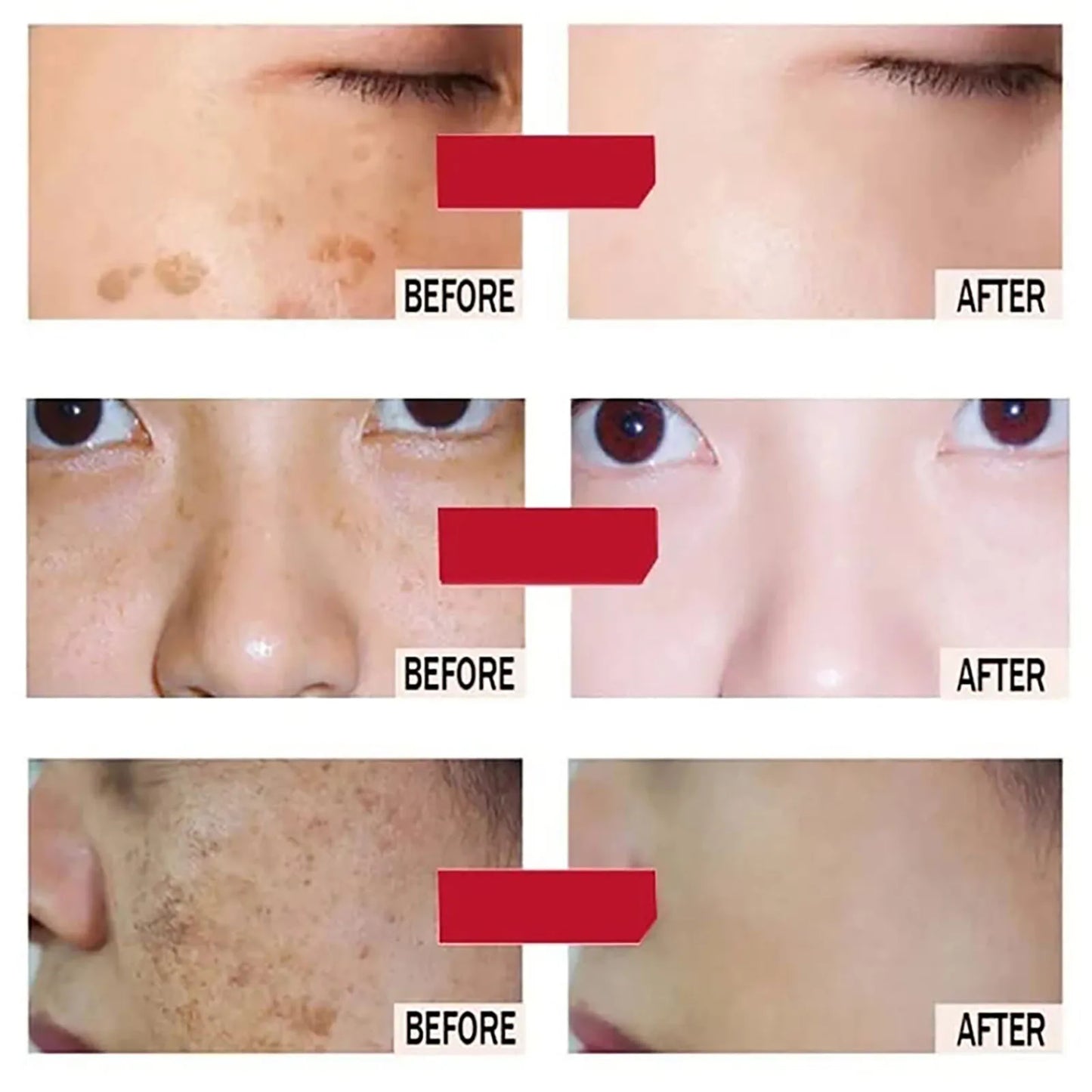 AILKE Kojic Acid Brightening Face Serum | Anti-Aging & Dark Spots