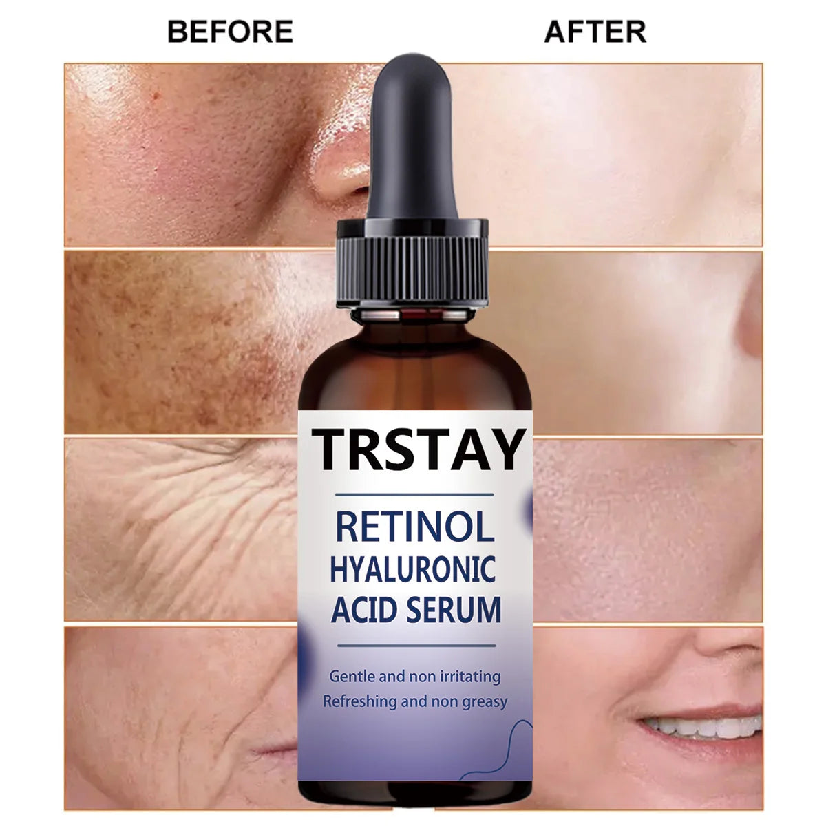 Retinol Hyaluronic Acid Serum, Gentle and Non-Irritating, Refreshing and Non-Greasy, Helps Improve Skin Condition Peaceful Pleasures Health and Wellness