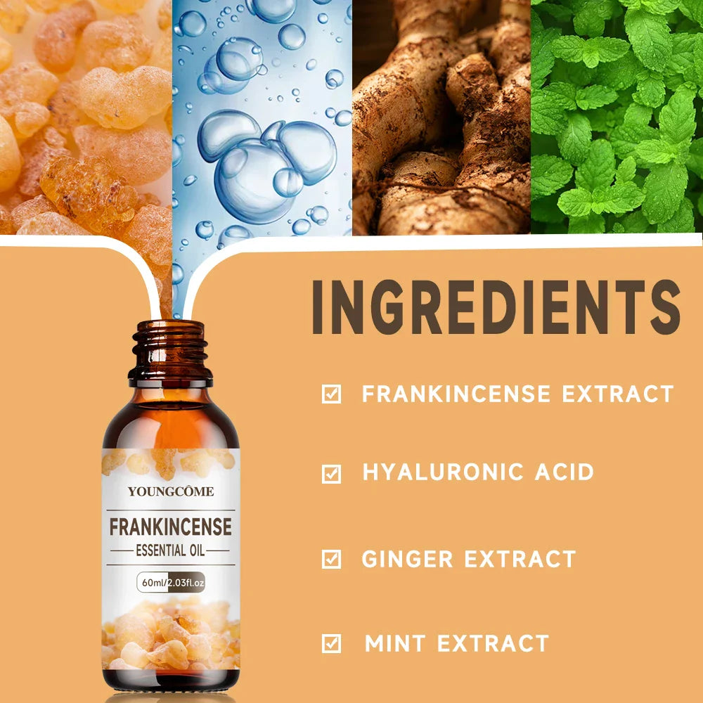 Frankincense Gum Essential Oil – Face, Body, Hair & Diffusion