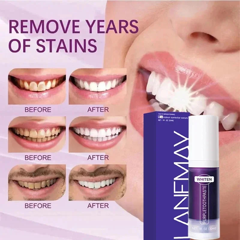 V34 Purple Teeth Whitening Toothpaste Remove Plaque Stains Cleaning Oral Hygiene Dental Bleach Tools Fresh Breath Beauty Health Peaceful Pleasures Health and Wellness