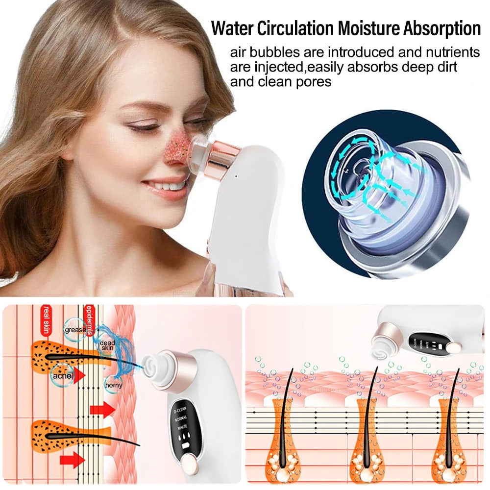 Blackhead Remover Pore Cleaner Black Dots Vacuum Cleaner Skin Pimple Acne Extractor Facial Cleaning Electric Black Head Removal Peaceful Pleasures Health and Wellness