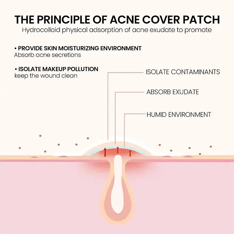 LGRAMER 200pc Acne Repair Patches – Fade Pimples & Blemishes