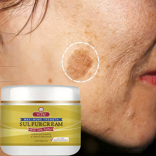 YCHZ Sulfur Face Cream – Brightening & Moisturizing | 60g Brightening Face Cream Oasis Select