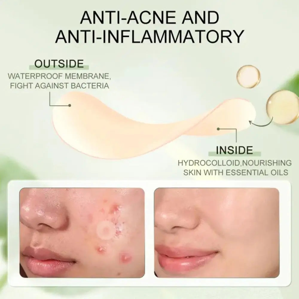 30pcs Hydrocolloid Acne Pimple Patch for Repair Peaceful Pleasures Health and Wellness
