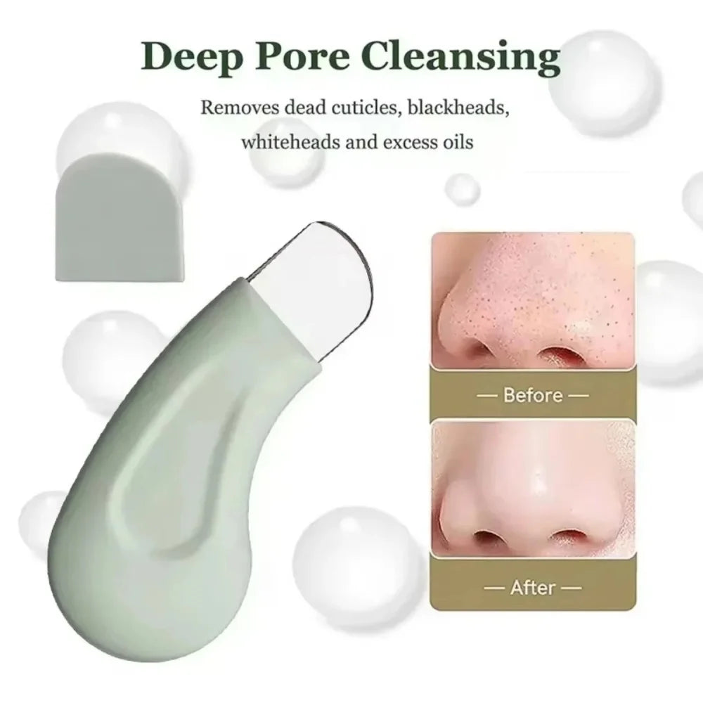 Blackhead & Whitehead Removal Tool – Face & Nose Pore Cleaner