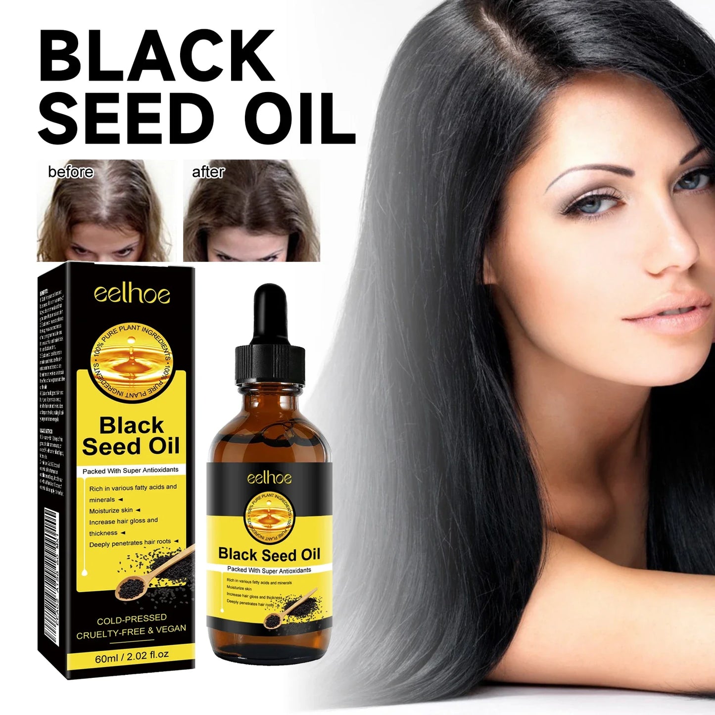 Eelhoe Hair Growth Essential Oil – Scalp & Follicle Treatment