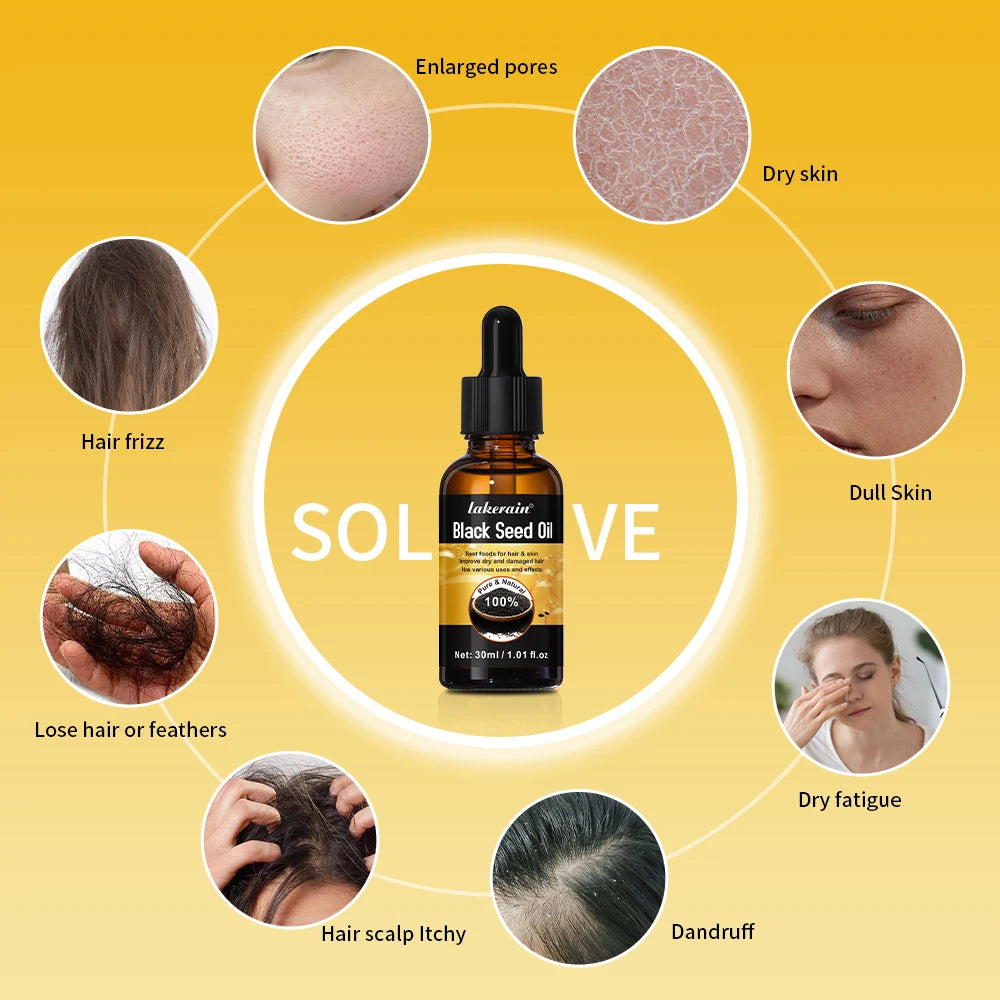 30ml Natural Essential Oils Plant Extract Serum Massage Oil For Hair Skin Body Relax Black Seed Oil Rosemary Oil 1 Bottle Peaceful Pleasures Health and Wellness