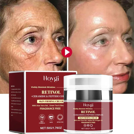 Retinol Face Cream – Firming, Brightening & Moisturizing 50g Retinol Face Cream Oasis Select Default Title