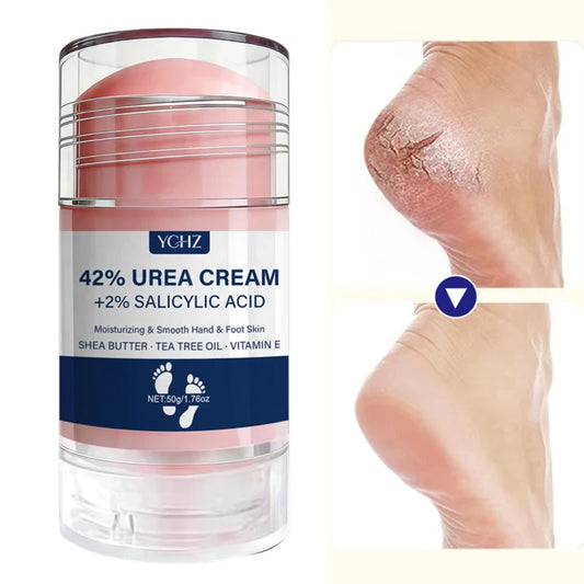 42% Urea & 2% Salicylic Acid Foot & Hand Cream Stick 50g Foot & Hand Cream Oasis Select