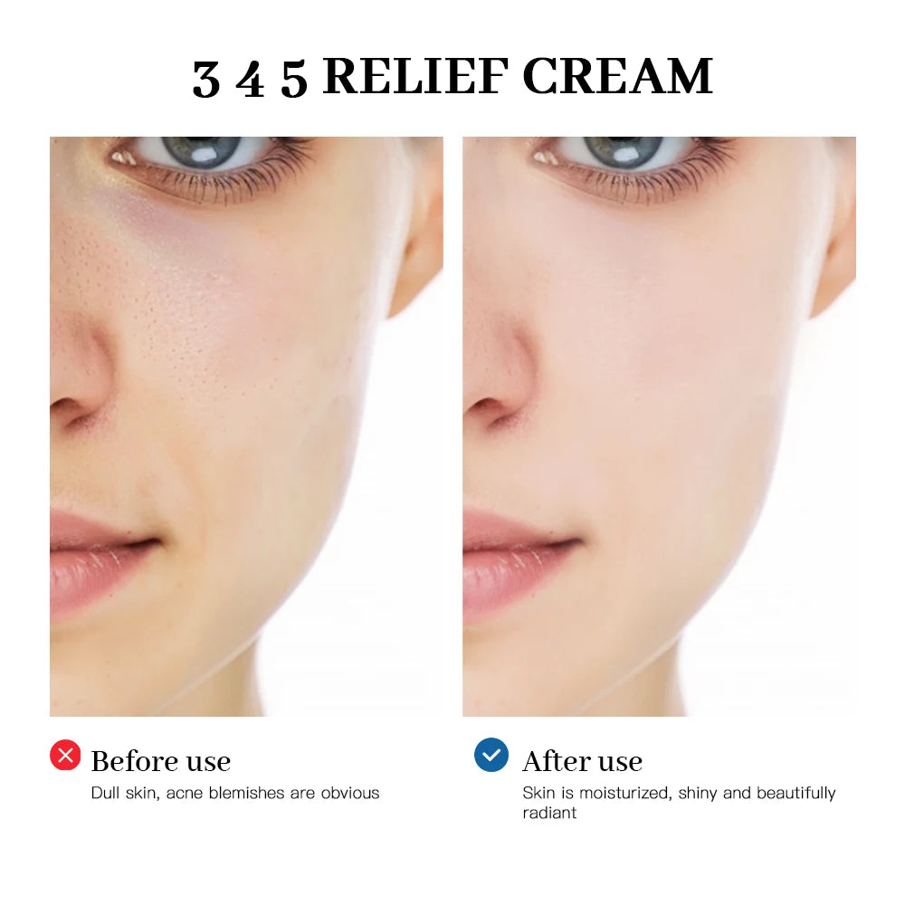 345 Relief Cream Address Blemishes Nourish The Skin and Provide Soothing Care Resulting In A Well-Rounded Skincare Solution Peaceful Pleasures Health and Wellness
