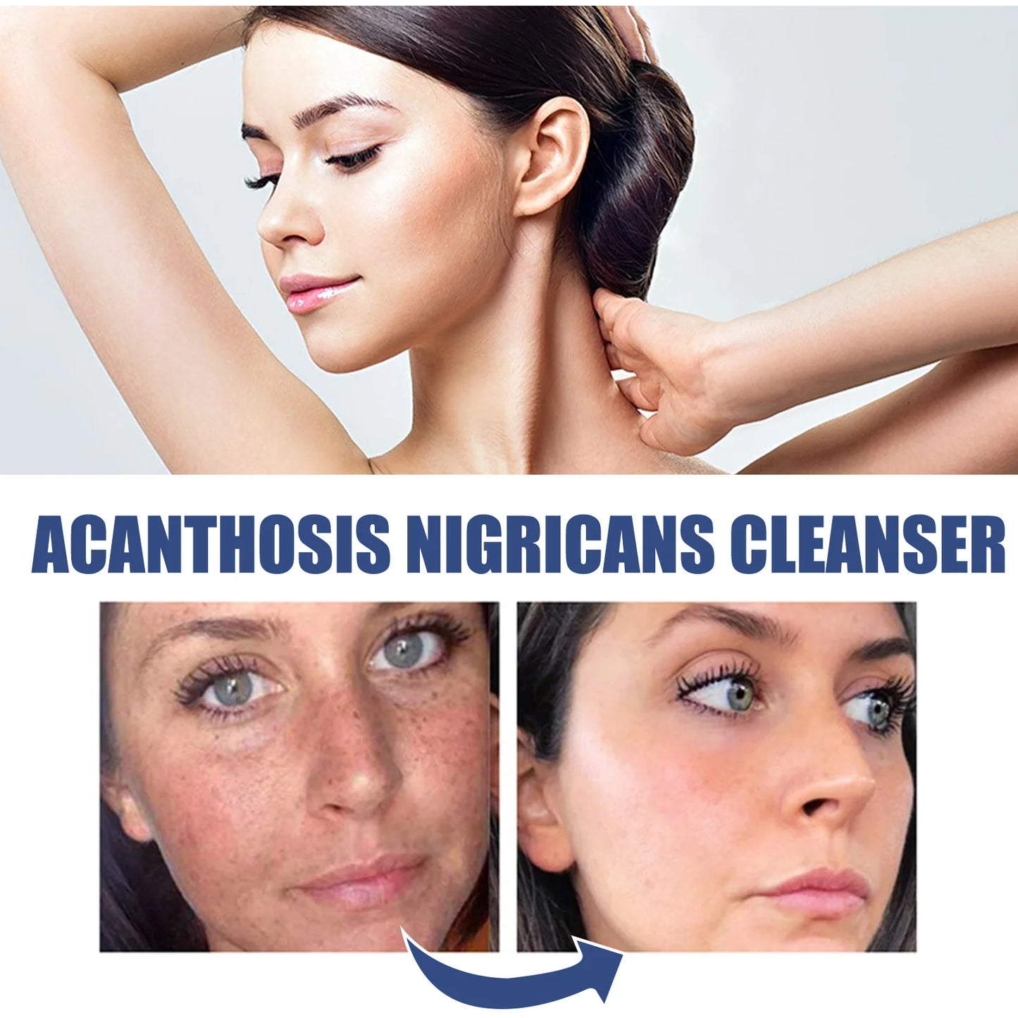 Brightening Face Wash – Acne, Dark Spots & Blackhead Remover
