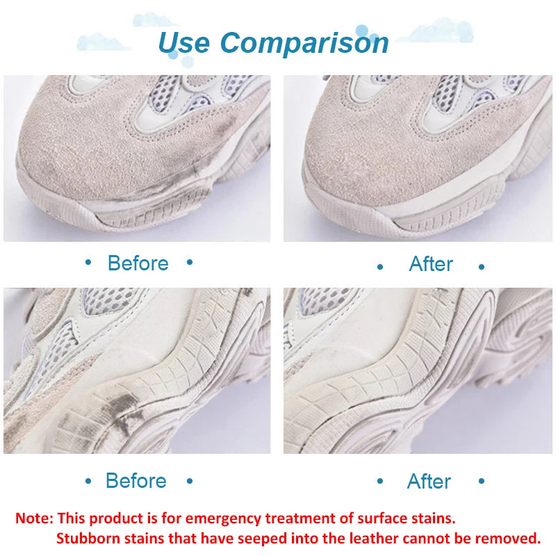 Suede & Sneaker Cleaning Eraser | Leather Stain Remover Tool