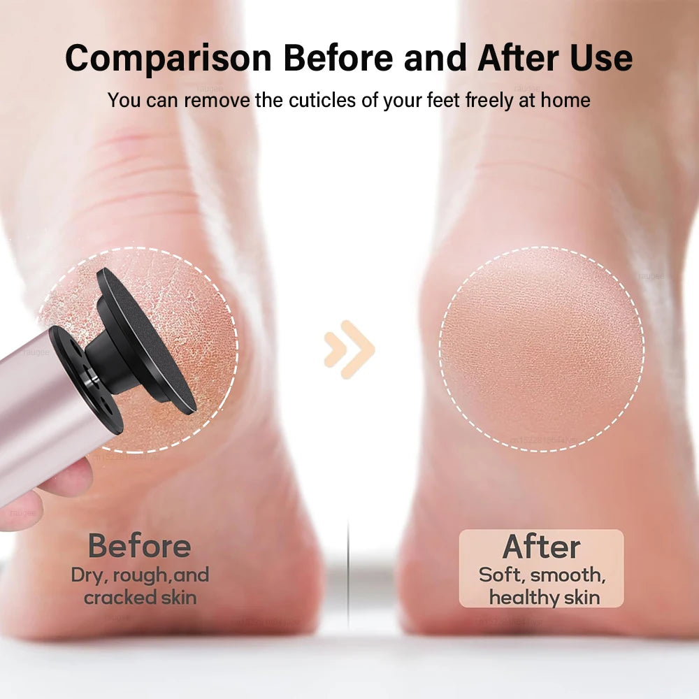 Electric Callus Remover Foot Exfoliation Sander Electric Foot Grinder for Feet Heel File Pedicure Machine Foot Dead Skin Remover Peaceful Pleasures Health and Wellness