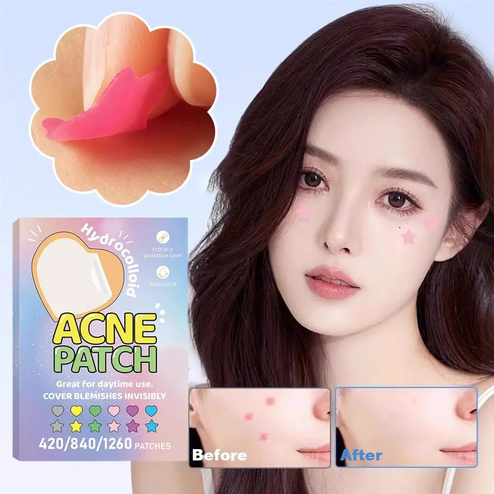Colorful Star & Heart Acne Patches – 420 to 1260 Pcs