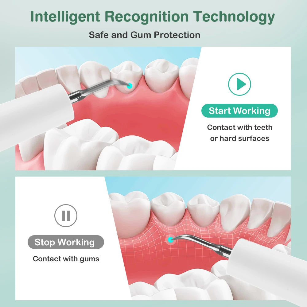 Tartar Remover for Teeth Electric Ultrasonic Dental Plaque Scaler 5 Modes LED Teeth Cleaning Kit 5 Speed Type-C Rechargeable Peaceful Pleasures Health and Wellness