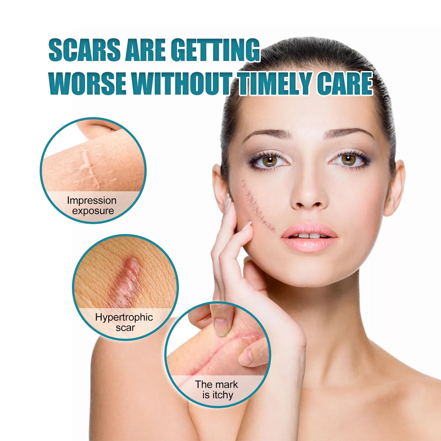 Silicone Scar Sheets Roll 4cm×150cm | Reusable Scar Tape
