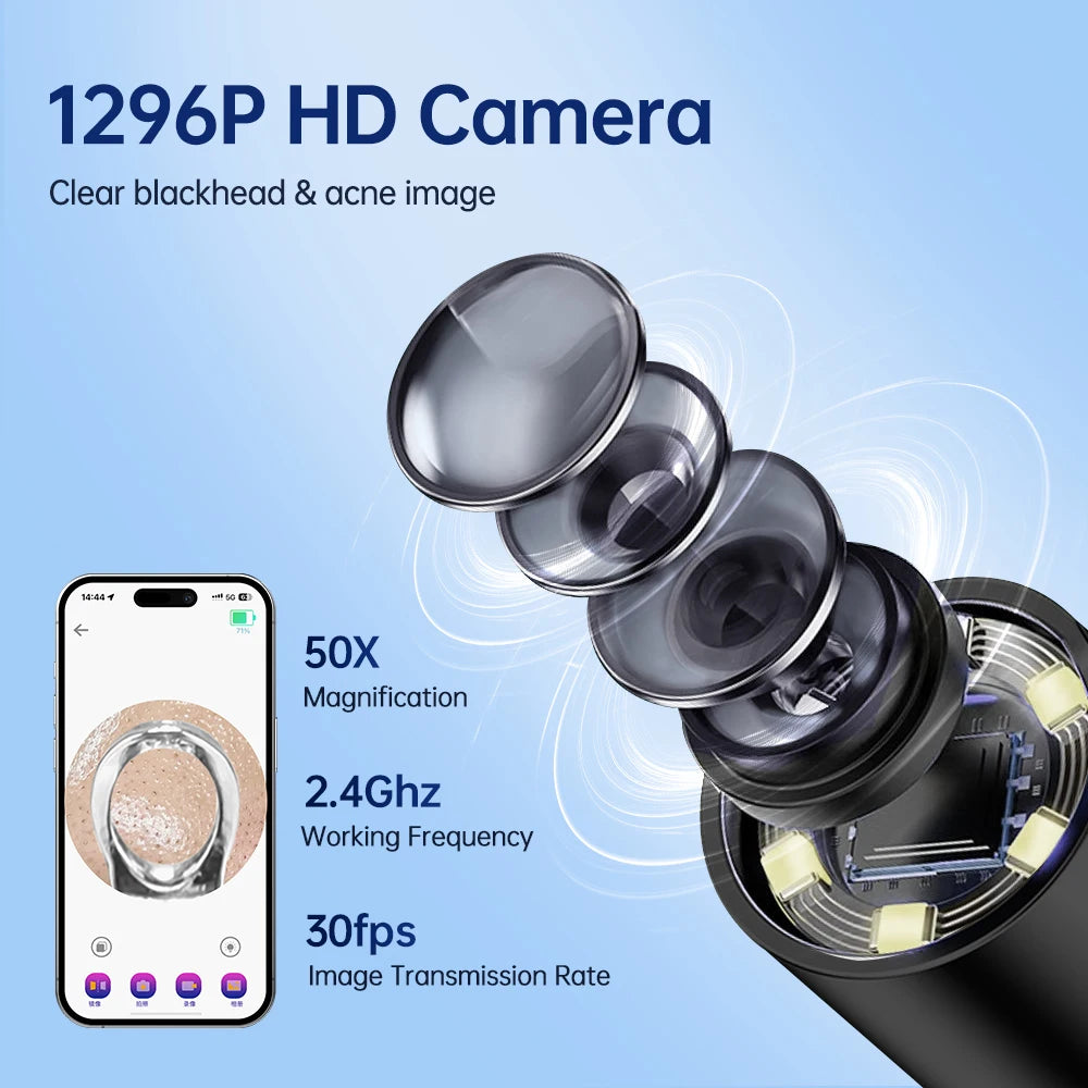 Visual Blackhead Remover with Camera Pimple Popper Extractor Tool Pore Cleaner Kit for Acne Comedone Whitehead Black Dots Remove Peaceful Pleasures Health and Wellness