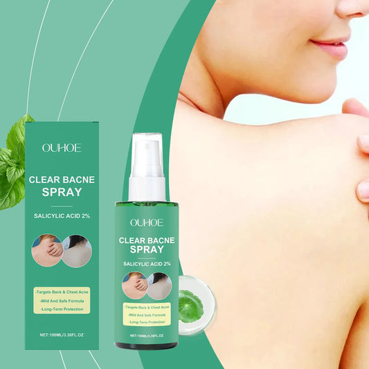 Back Acne Treatment Spray – Oil Control & Spot Repair Mist Body Acne Spray Oasis Select