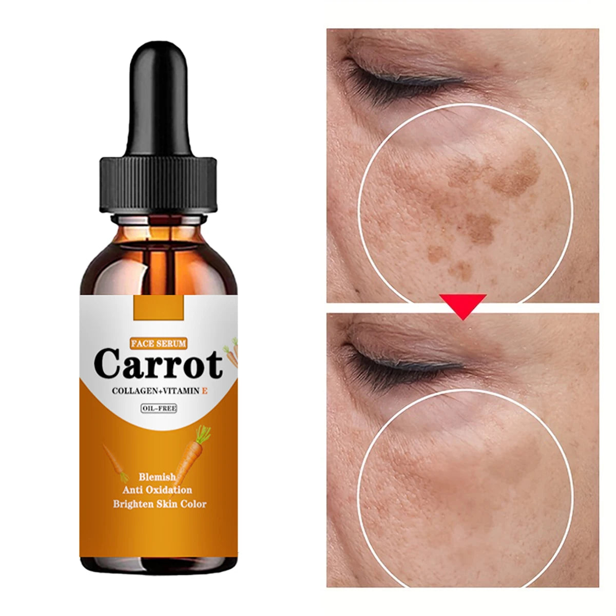 New Carrot Essence Essential oils Dark Spot Corrector Face Whitening Serum Brighten Blemish Freckle Remover 100% Natural Peaceful Pleasures Health and Wellness