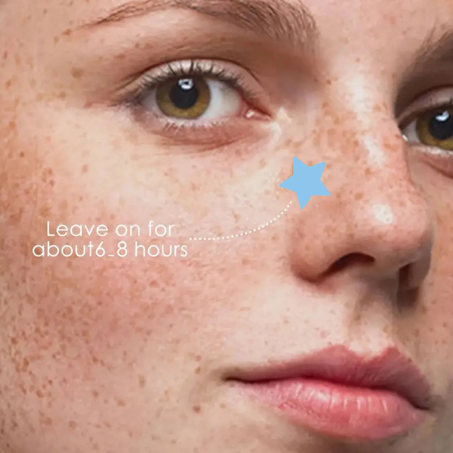 Star-Shaped Hydrocolloid Acne Patches 40 Pack – Alcohol-Free