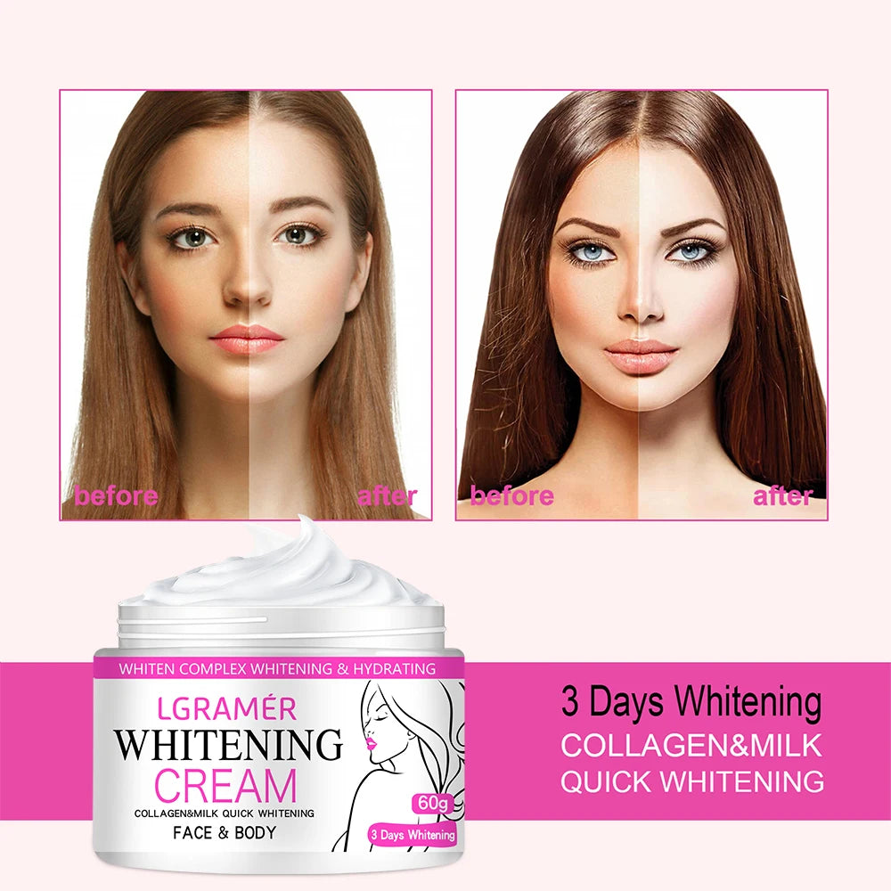 Whitening Body Cream – Dark Spot Remover for Armpit, Knee & Elbow