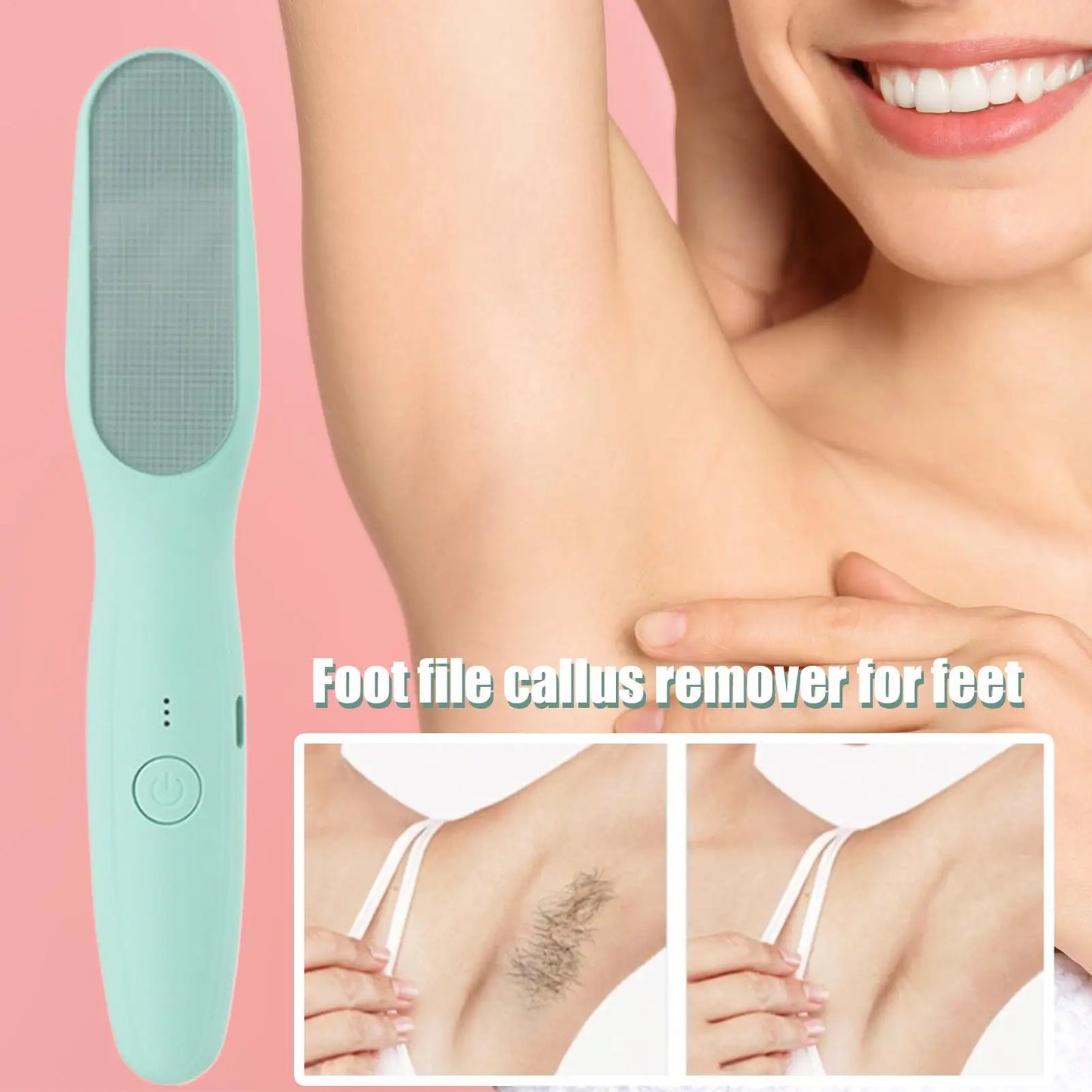 Electric Foot Callus Remover – Rechargeable 6-Speed Foot File