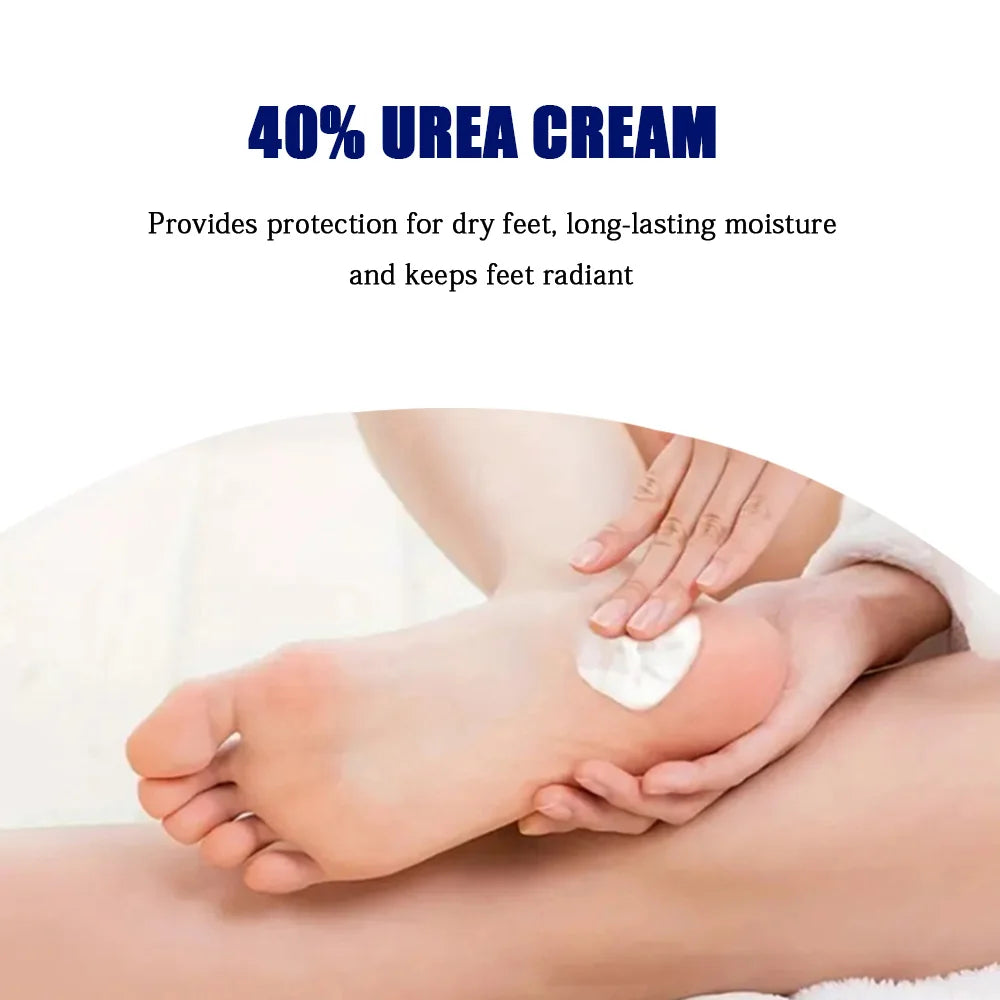 YOUNGCOME 40% Urea & 2% Salicylic Acid Foot & Hand Cream Hand & Foot Cream Peaceful Pleasures Health and Wellness