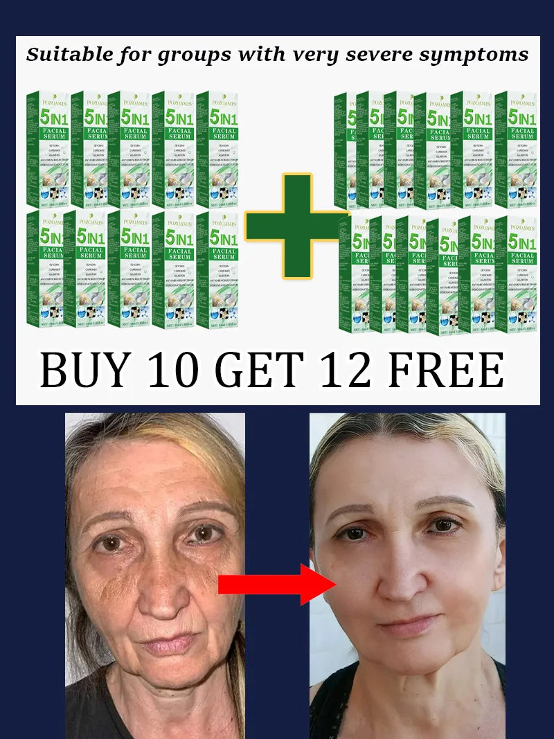 POZOAMIS Anti-Aging Face Serum – Reduce Wrinkles & Fine Lines