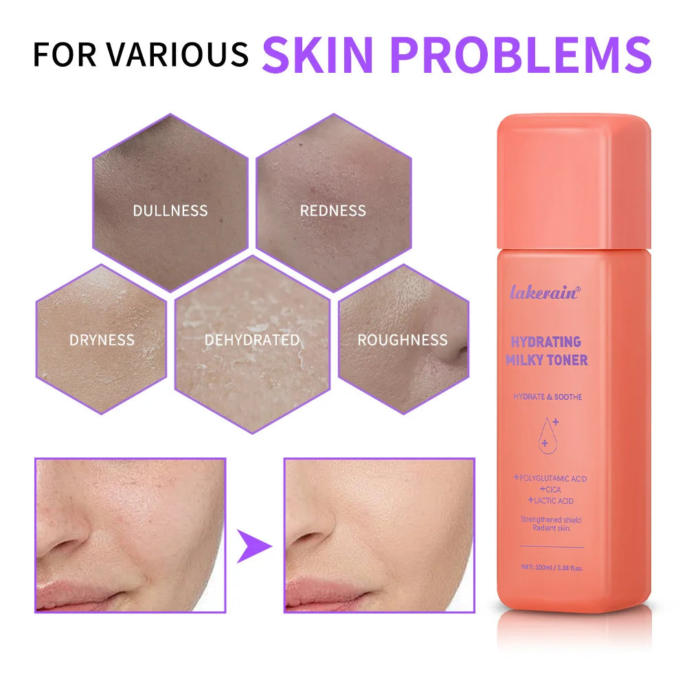 Hydrating Milky Toner Repair Skin Ultra Hydrating Toner for Face Soothes Skin Moisture Reduces Redness Barrier Skincare Peaceful Pleasures Health and Wellness