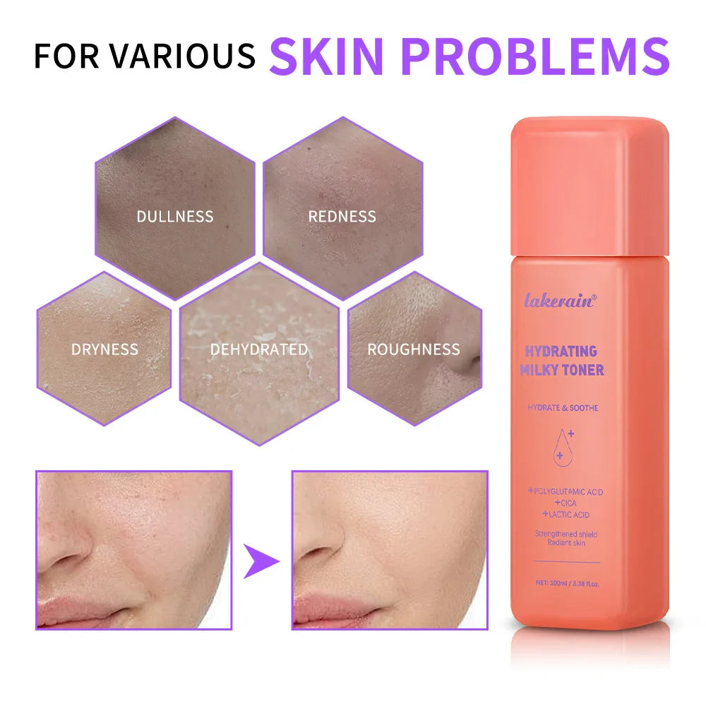 Hydrating Milky Toner – Deep Moisture & Barrier Repair | 100ml