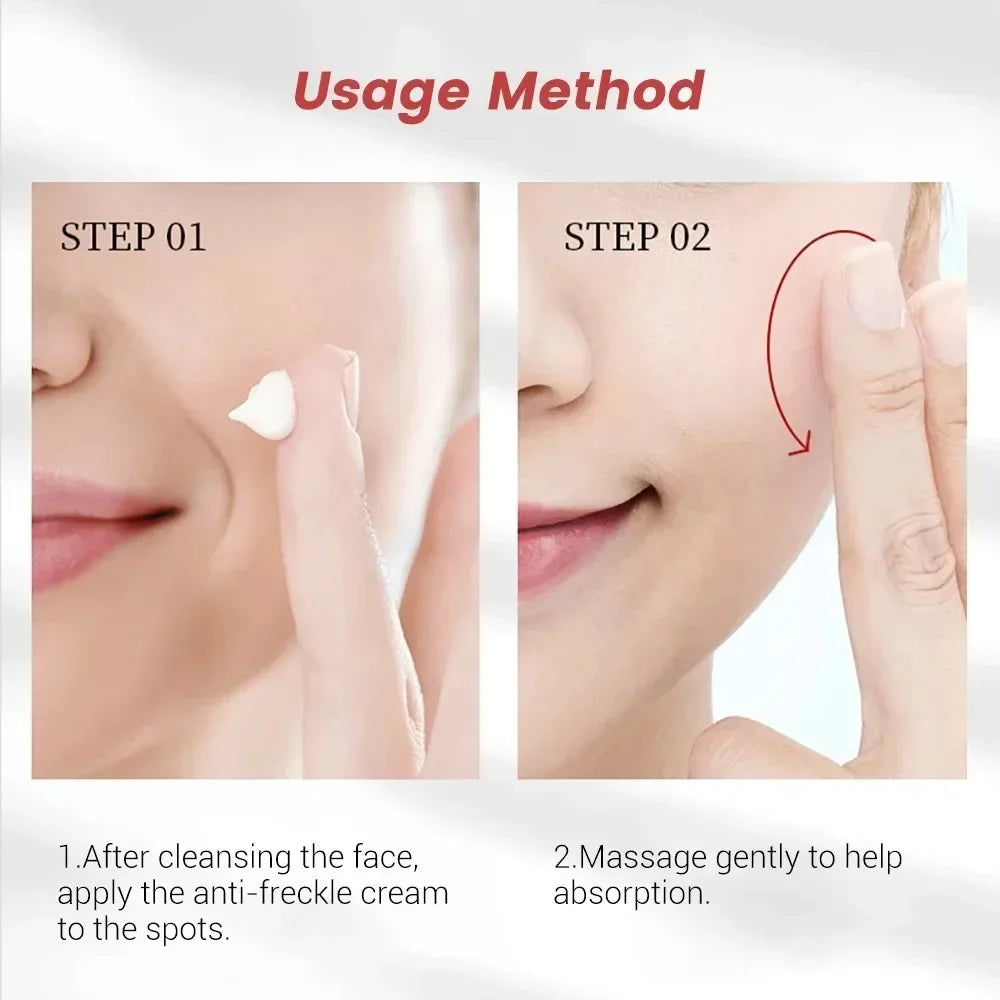 1/3/5pcs Whitening Freckle Cream Niacinamide Remove Dark Spot Cream Anti Freckle and Aging Cream Fade Pigmentation Melasma Skin Peaceful Pleasures Health and Wellness