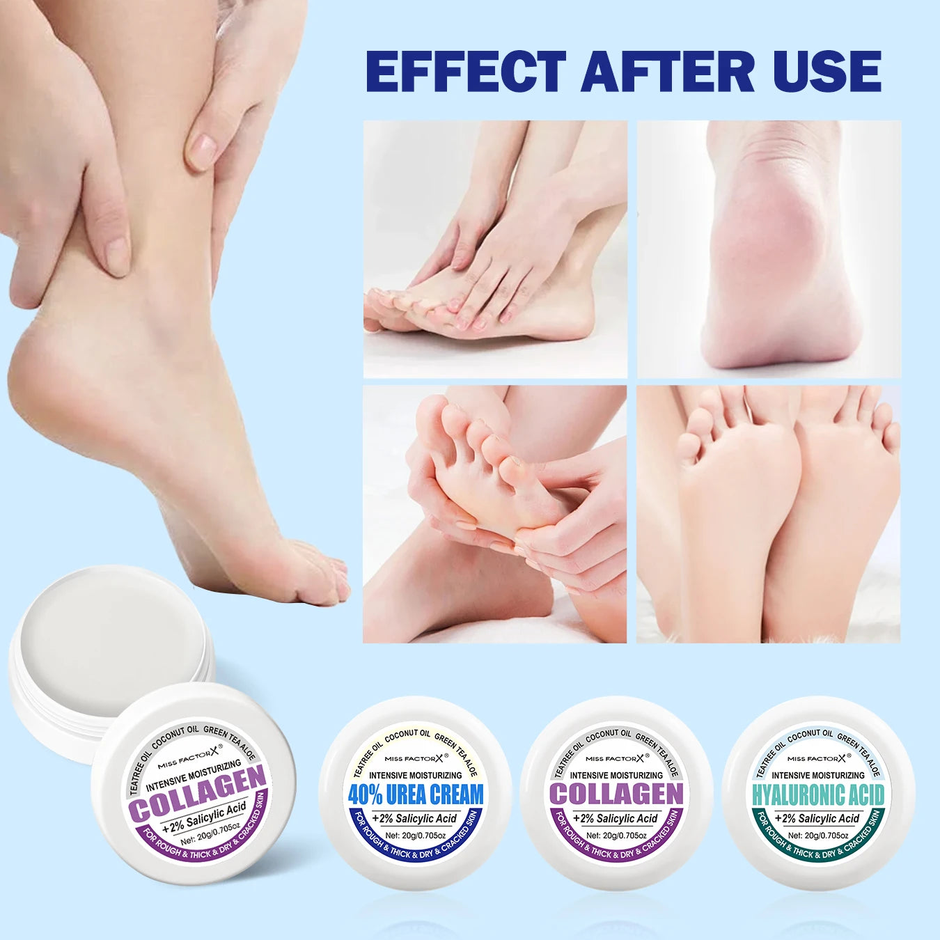 3PCS/Box Urea Foot Cream Moisturizer, with Salicylic Acid, for Dry and Cracked Feet - Hand and Foot Care for and Women Peaceful Pleasures Health and Wellness
