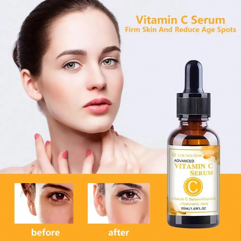 YOUNGCOME Vitamin C Facial Serum 50ml | Dark Spot Remover