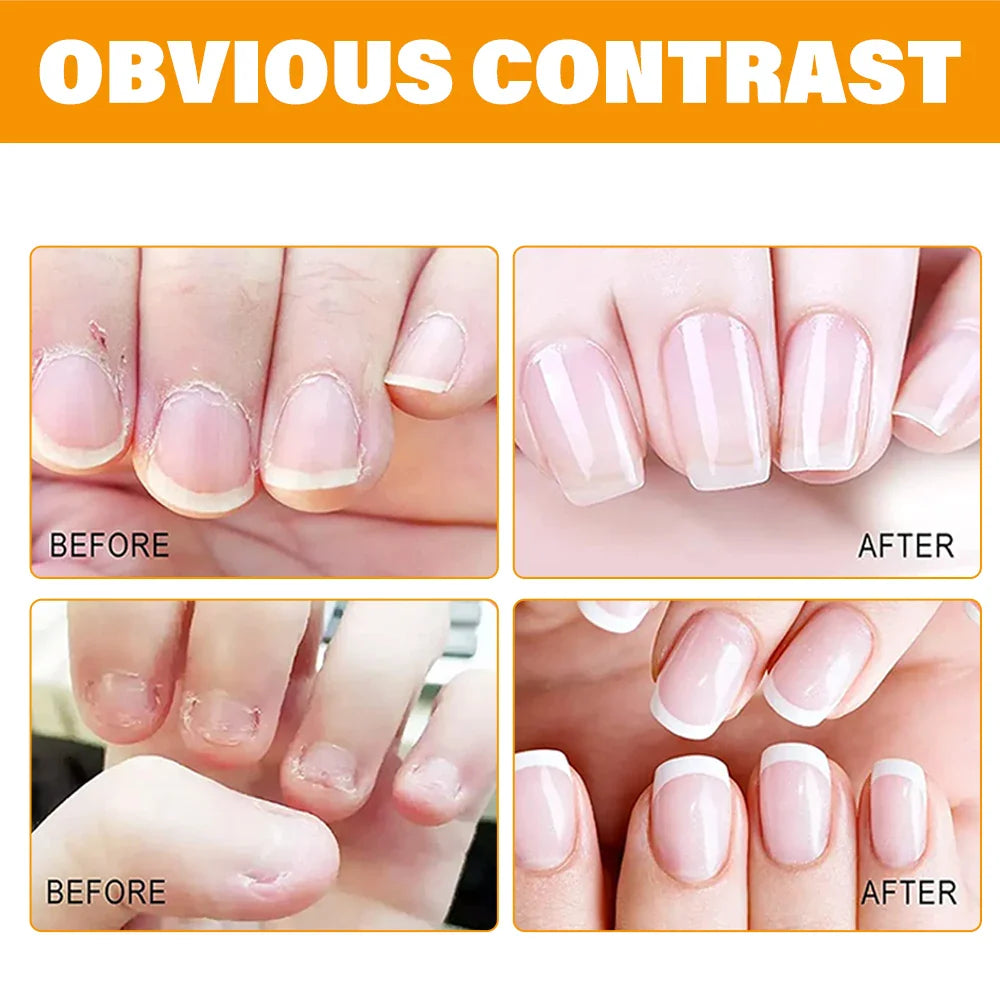 Honey Nail Oil Cuticle Pen – Strengthener for Brittle Nails