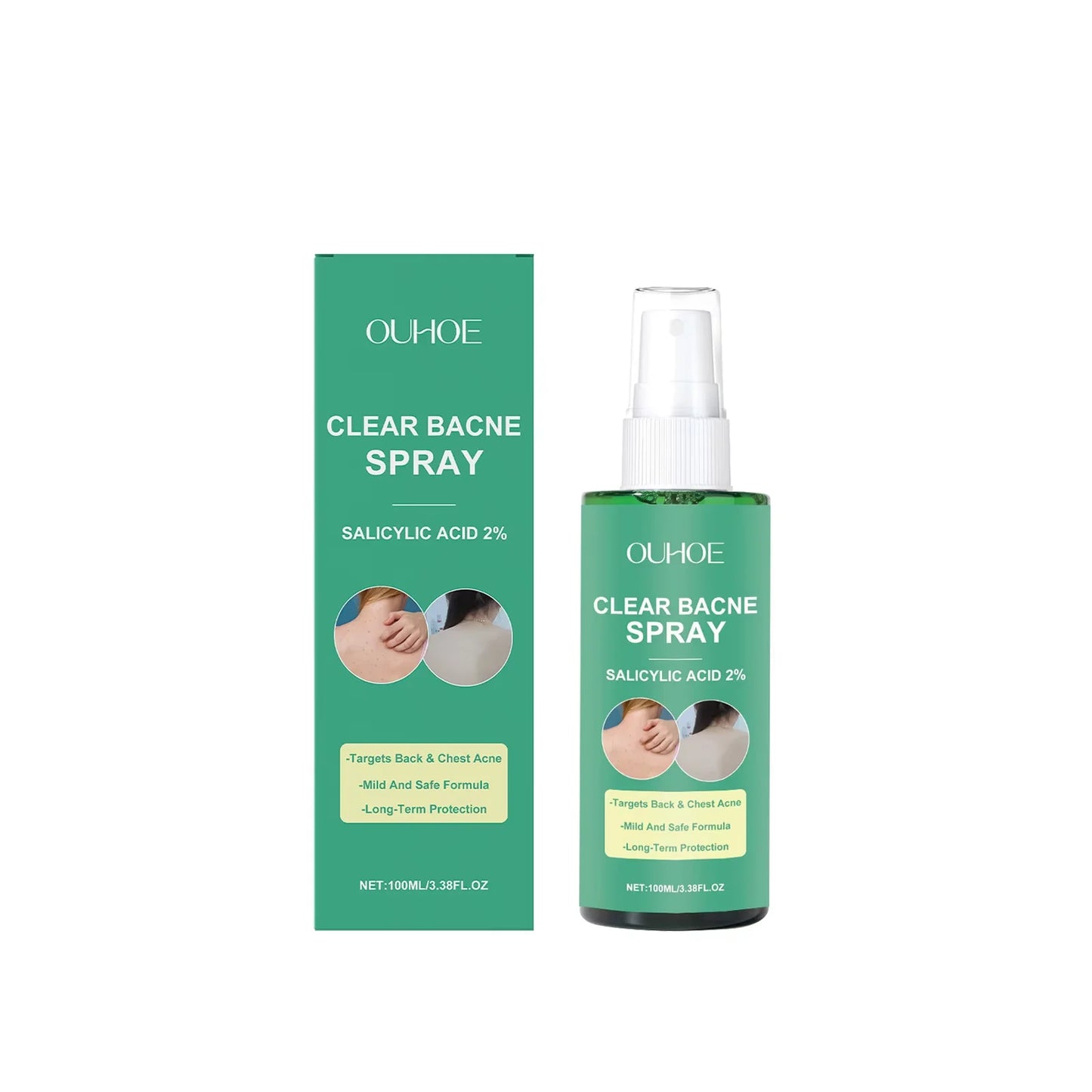 Back Acne Treatment Spray – Oil Control & Soothing Body Spray