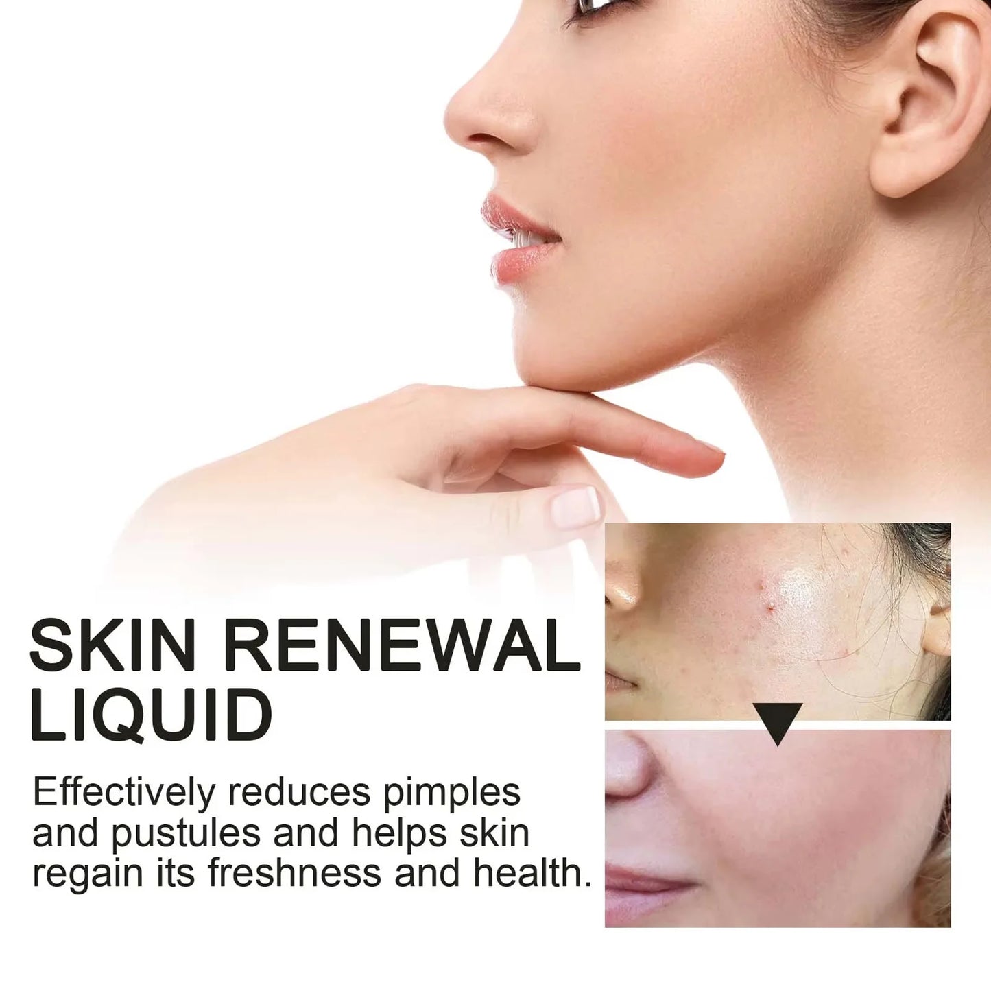 2% BHA Salicylic Acid Serum – Clear Pores & Fade Dark Spots